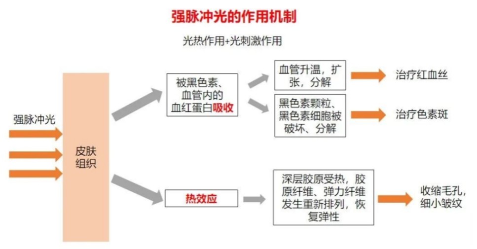 光子嫩肤