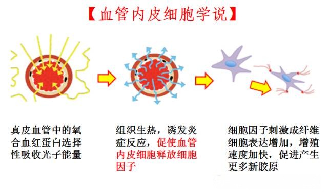 光子嫩肤